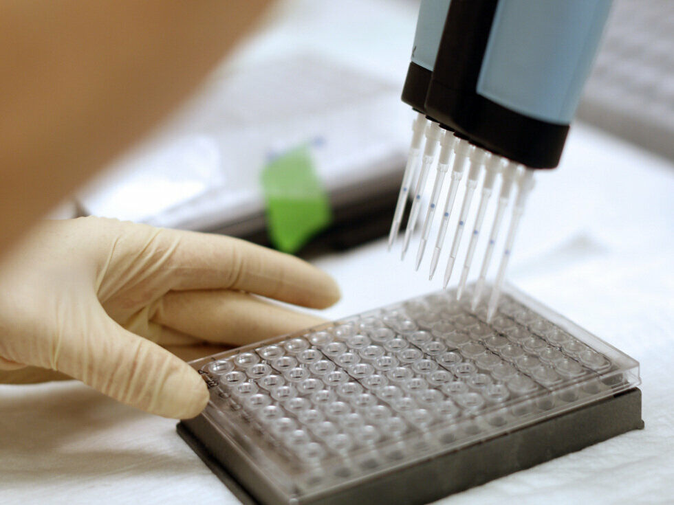 Gewichtsabnahme bei Krebs: Erste Schritte zur Therapie