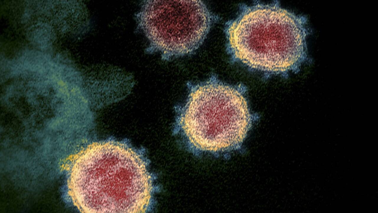 Die Ausbreitung des SARS-CoV-2-Virus nimmt wieder zu 