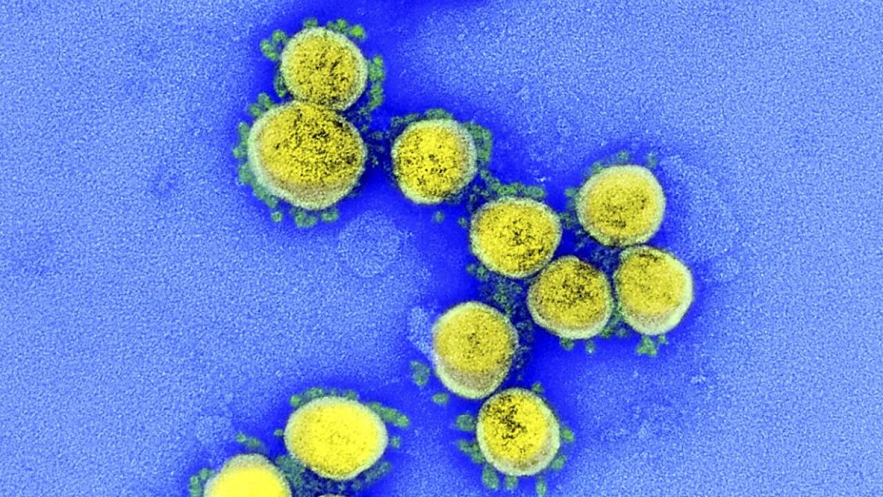 SARS-CoV-2-Infektionen betreffen immer mehr Jüngere 