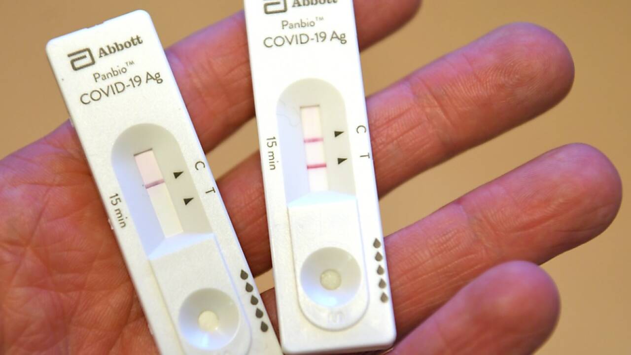 7,35 Prozent der Bevölkerung haben sich schon mit SARS-CoV-2 infiziert 