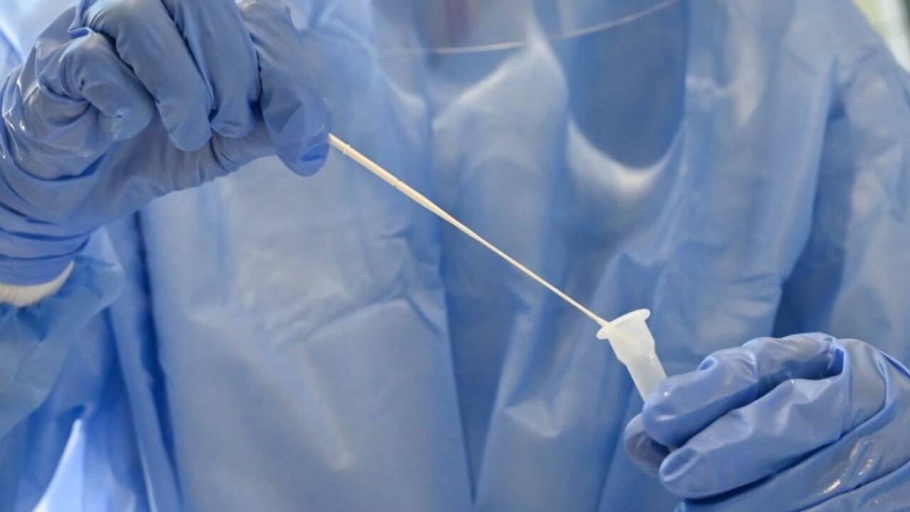 Die Zahl der Neuinfektionen ist leicht rückläufig 