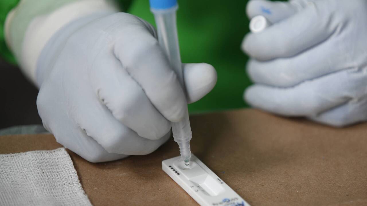 Das Testergebnis soll innerhalb von 20 bis 24 Stunden vorliegen.  