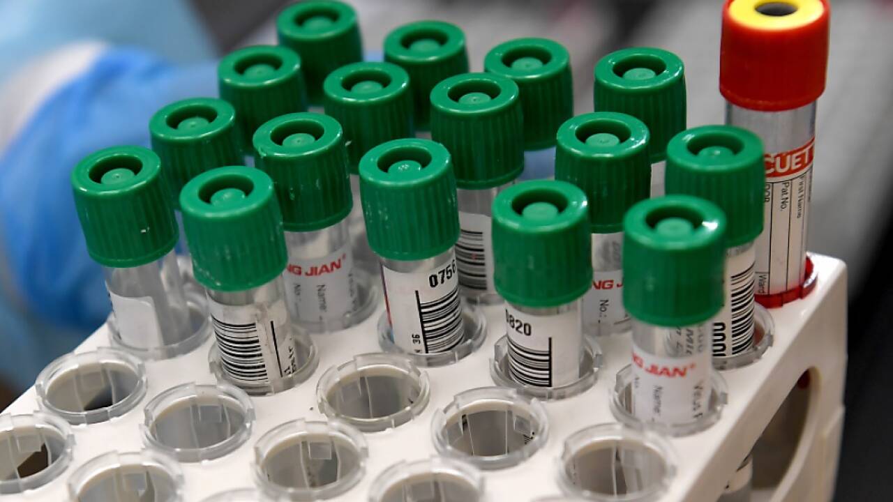 Bei der Auswertung von PCR-Tests kommt es in Salzburg zu Verzögerungen 