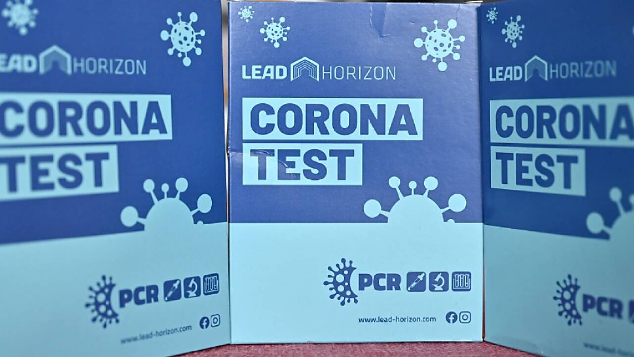 Corona-Tests könnten bald nicht mehr gratis sein. 