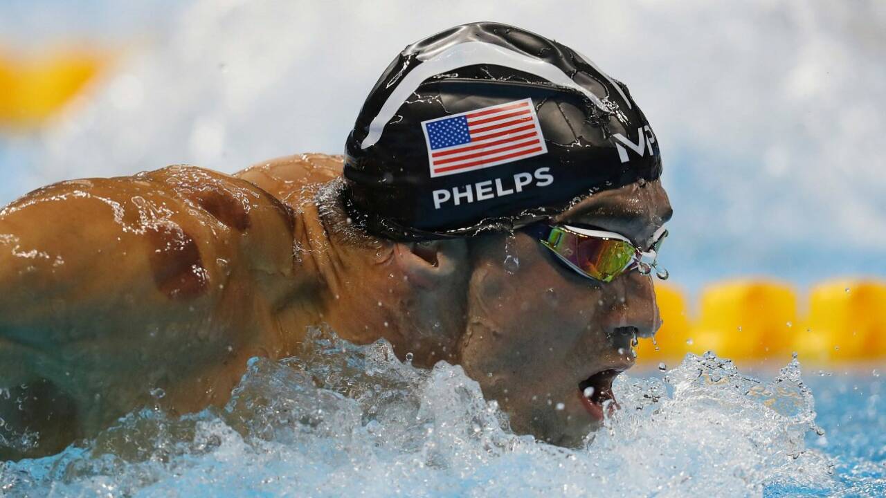 Schröpfen: Dunkle Flecken auf Körper von Olympiasieger Phelps
