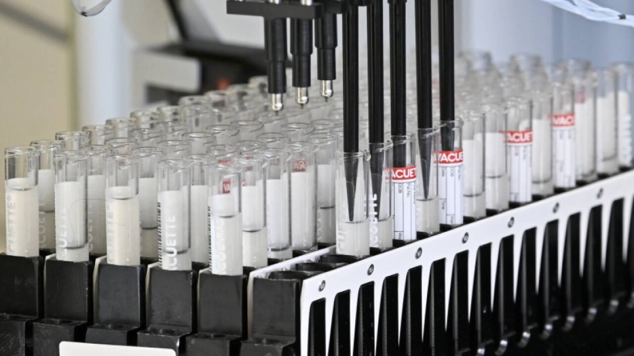 Der Bund will die Zahl der Tests beschränken 