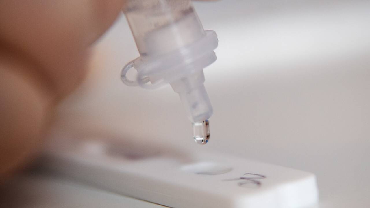 Das wahllose Gratis-Testen wird beendet 