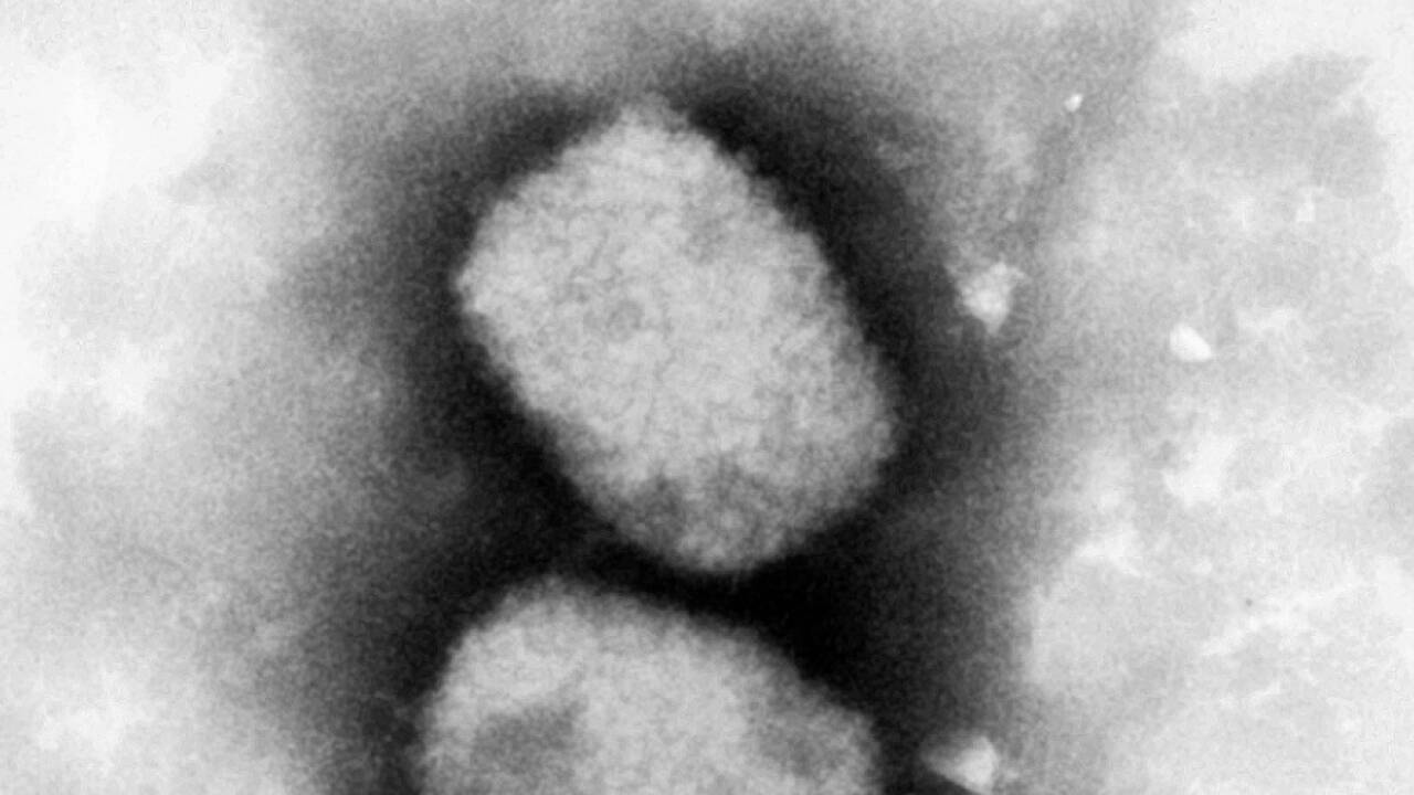 Diese vom Robert Koch-Institut (RKI) zur Verfügung gestellte elektronenmikroskopische Aufnahme zeigt das Affenpockenvirus. Diese vom Robert Koch-Institut (RKI) zur Verfügung gestellte elektronenmikroskopische Aufnahme zeigt das Affenpockenvirus.