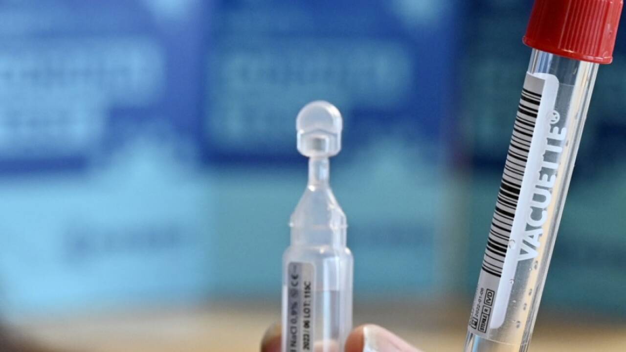 Fast jeder zweite PCR-Test am Sonntag fiel positiv aus 