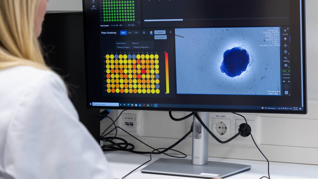 In einem Monat können 100.000 Organoide erzeugt werden.  
