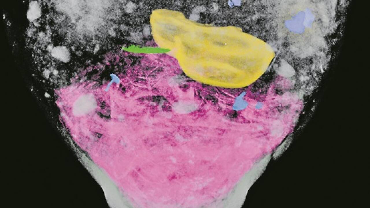 Ausgegrabene Urnen werden mit Computertomographie durchleuchtet, dann Objekte sowie menschliche, tierische und pflanzliche Überreste geborgen. Im nachbearbeiteten Scan sind Leichenbrandfragmente (rosa), ein Öllämpchen (gelb), Nägel (blau) und ein weiterer Metallgegenstand (grün) zu erkennen.  
