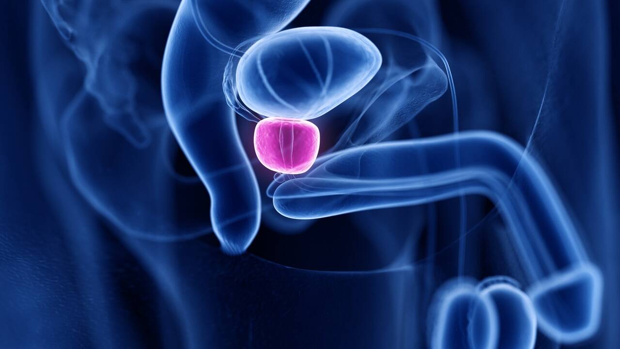 Die Prostata ist eine Drüse, die direkt unterhalb der Harnblase sitzt und in der sich ständig Zellen vermehren. 