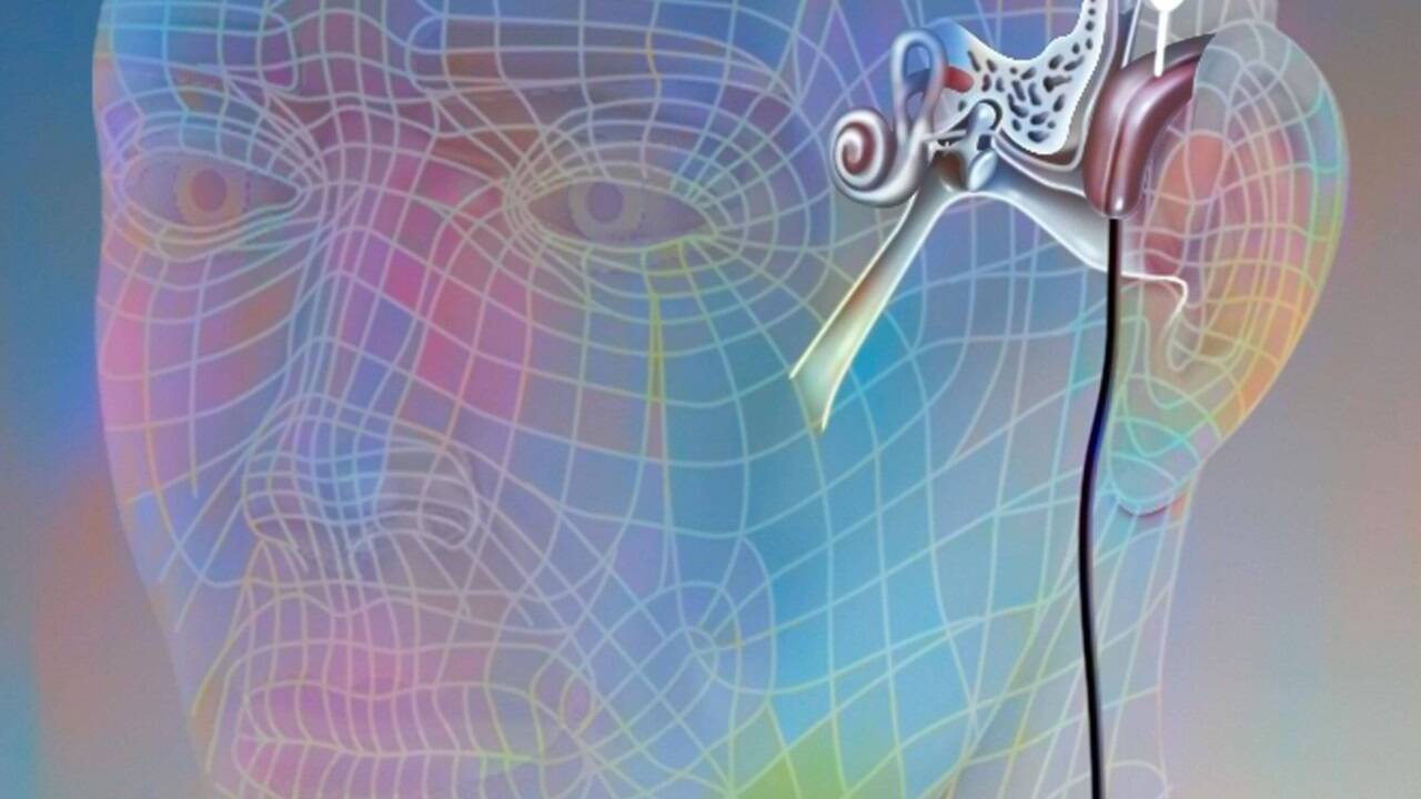 Das Cochlea-Implantat gibt ertaubten oder hochgradig schwerhörigen Menschen ihr Gehörvermögen zurück. 