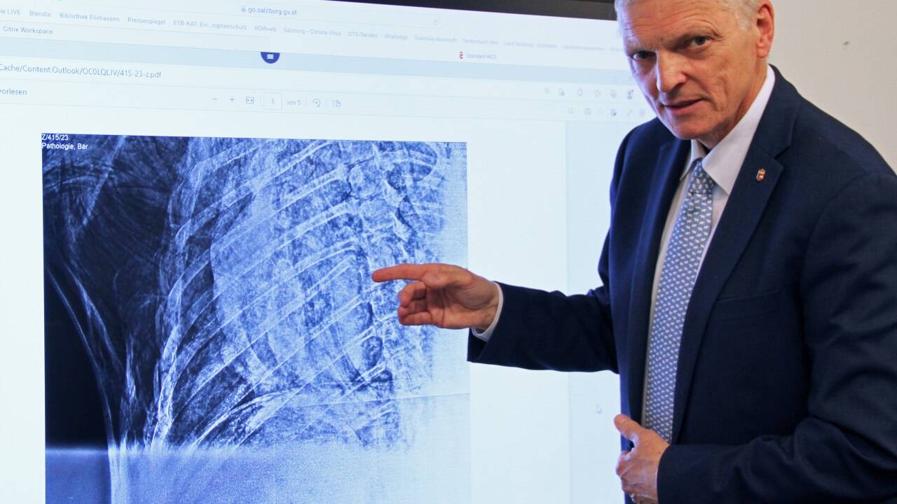 Landesveterinärdirektor Josef Schöchl mit den Röntgenaufnahmen. 
