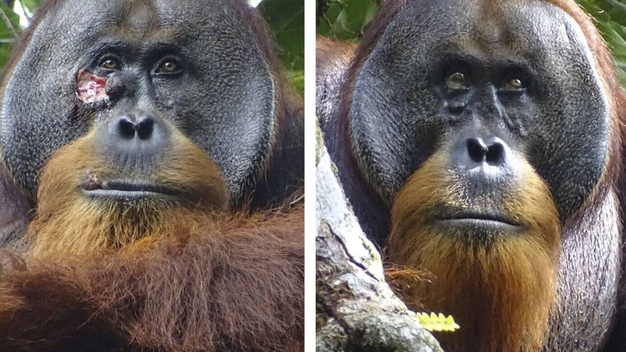 Zum ersten Mal konnten Forscher dokumentieren, dass ein Wildtier eine Pflanze medizinisch gegen Verletzungen nutzt. Im Bild der Verlauf der Wundheilung bei Orang-Utan Rakus. Zum ersten Mal konnten Forscher dokumentieren, dass ein Wildtier eine Pflanze medizinisch gegen Verletzungen nutzt. Im Bild der Verlauf der Wundheilung bei Orang-Utan Rakus.