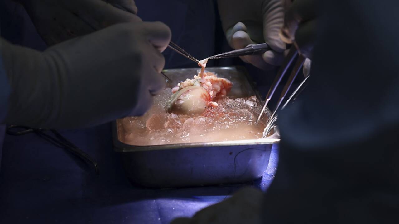 Keine Hinweise auf Zusammenhang mit Transplantation 