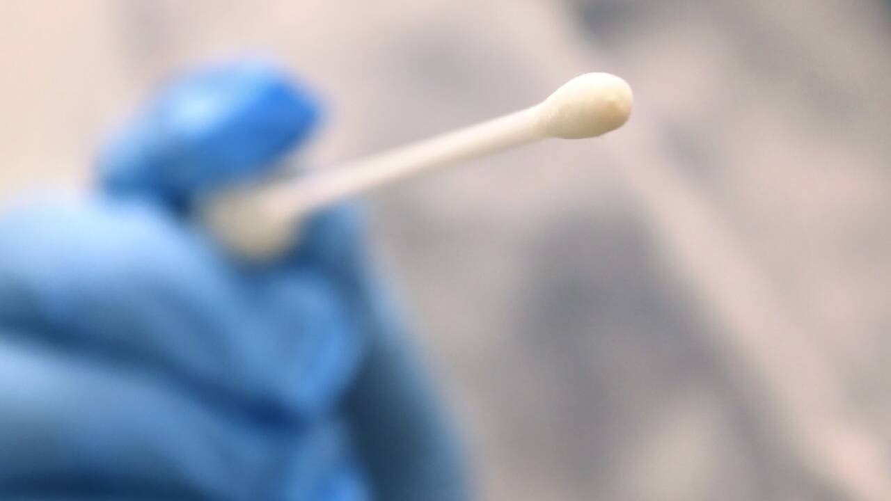 Wangenabstrichset für Typisierung zu Hause anfordern 