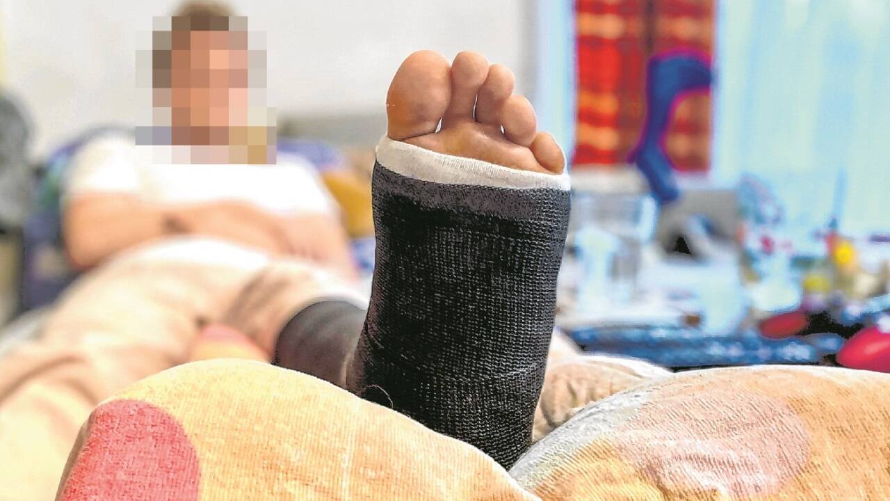 Schwer verletzt: Philipp muss noch wochenlang Gips tragen. 