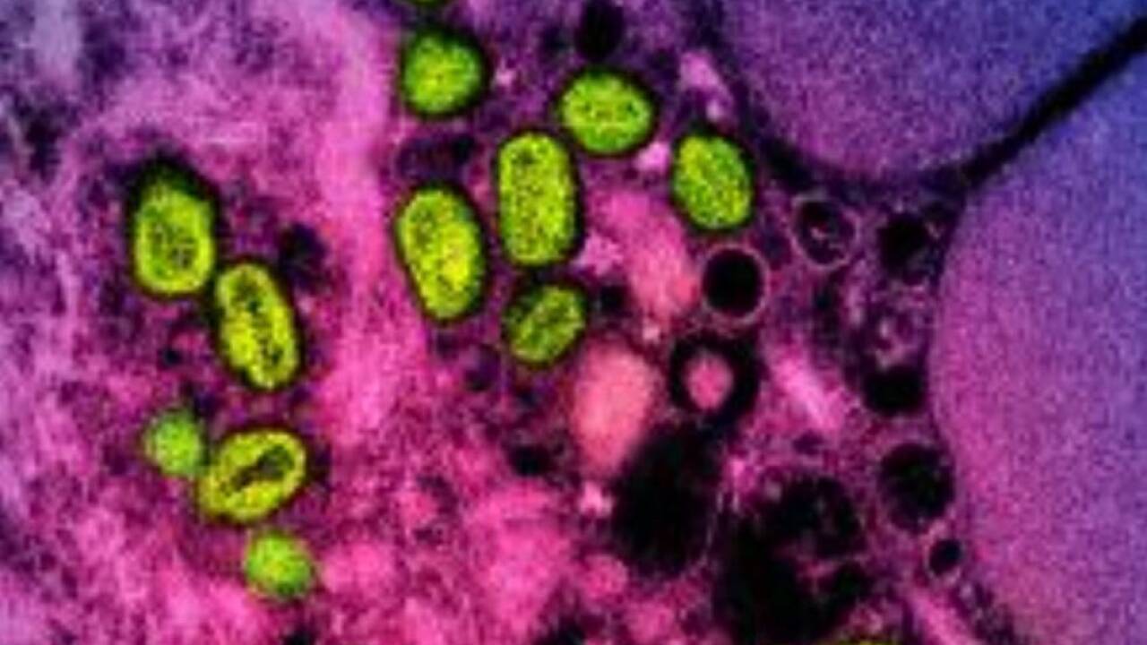 Grüne Mpox-Partikel sorgen für Alarm bei Gesundheitsbehörden 