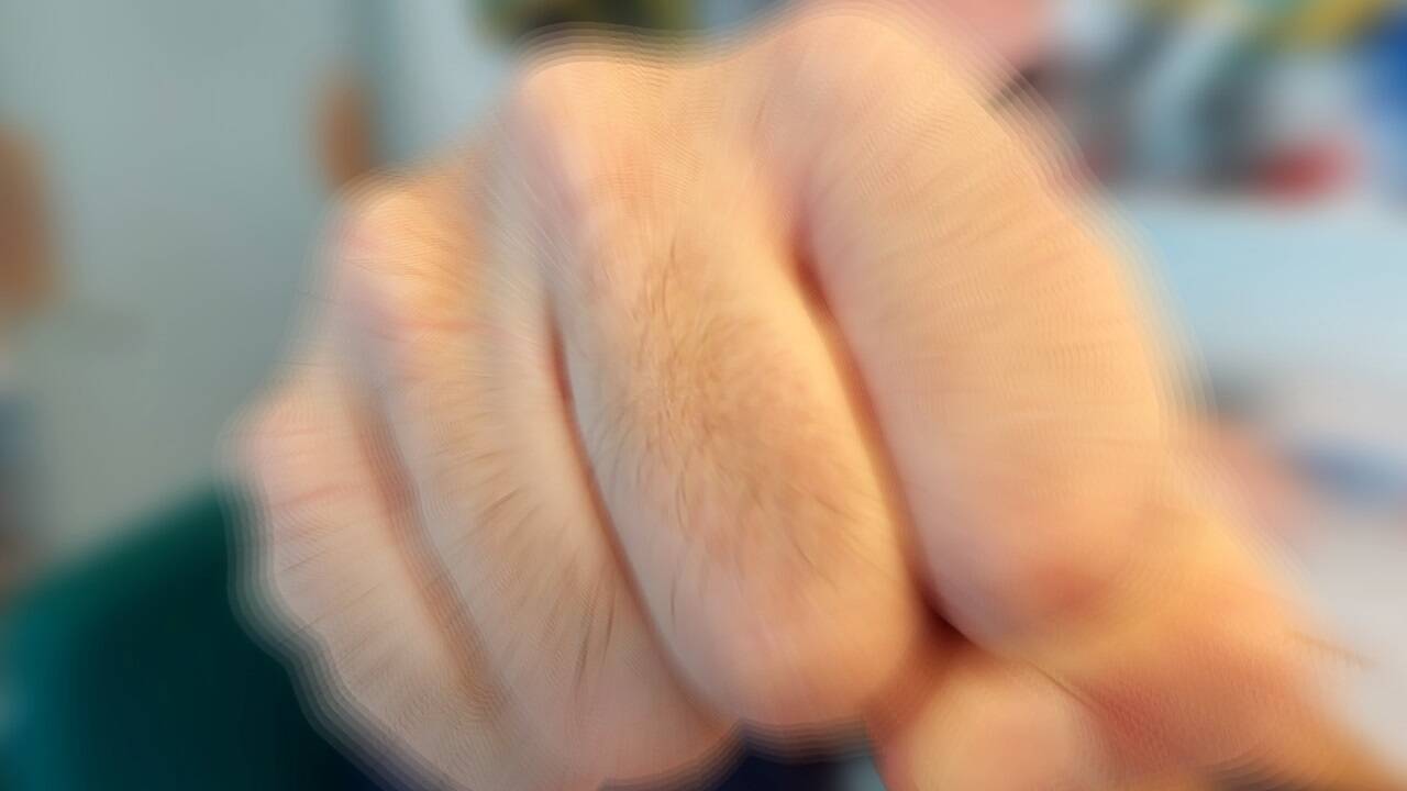 Faustschlag ins Gesicht (Symbolbild).  Faustschlag ins Gesicht (Symbolbild).