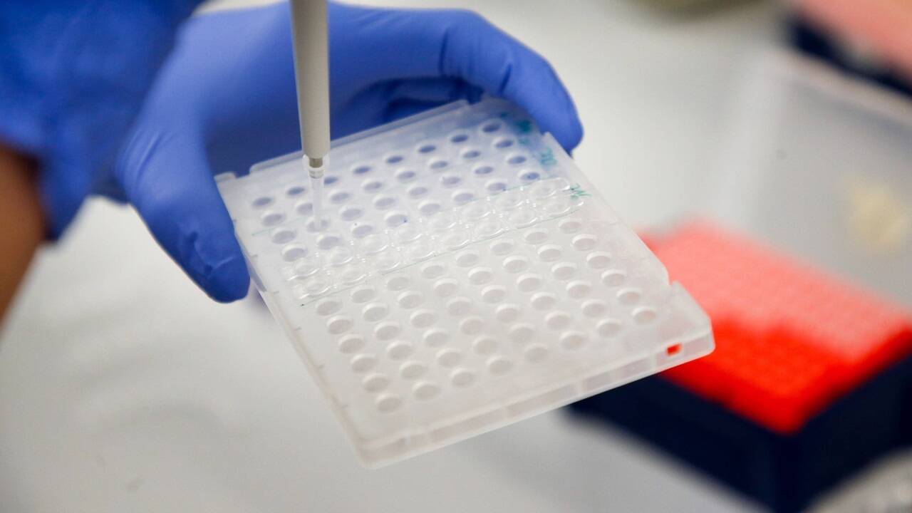 Untersuchung des Virus: Coronaerkrankungen stehen an der Tagesordnung (Symbolfoto).  