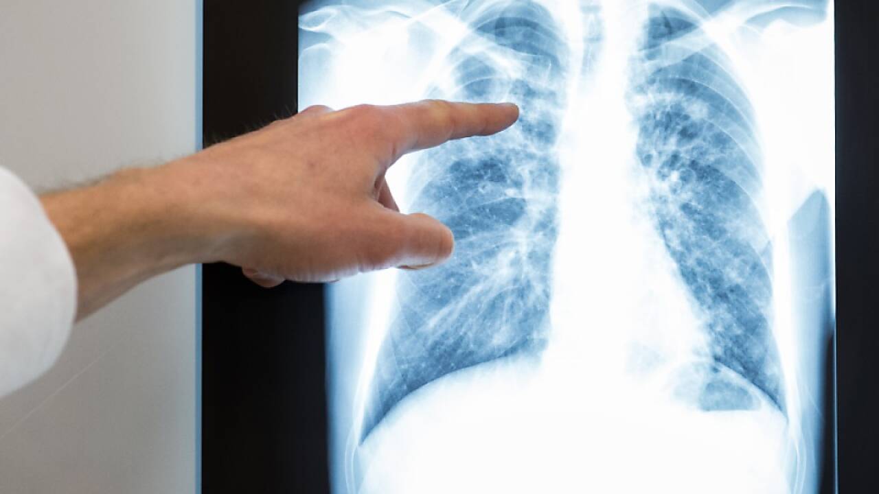 Das Masterstudium Medizin der SFU ist wieder zugelassen 