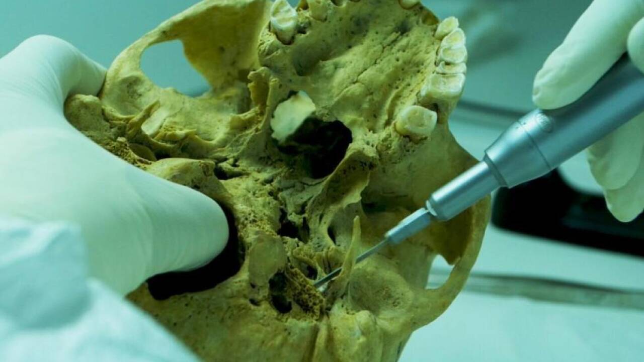 Beprobung eines Schädels am Budapester Institut für Archäogenomik 