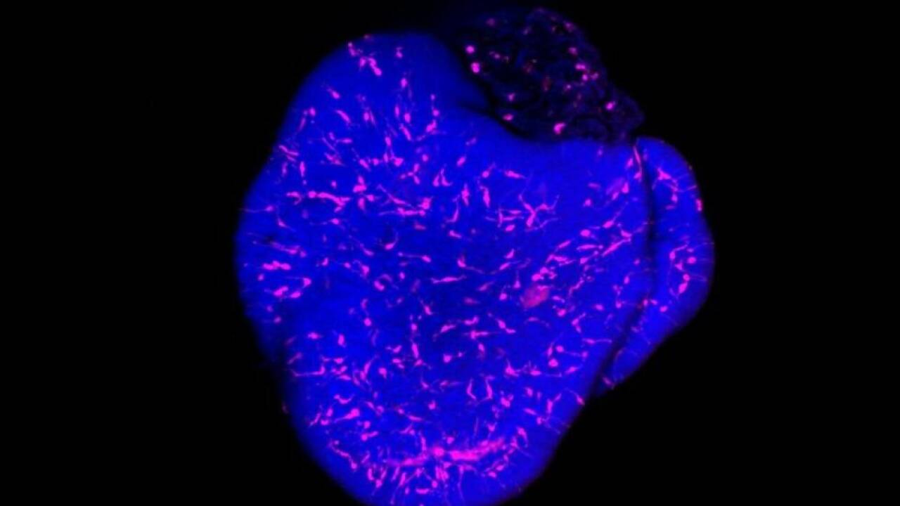 Rosa leuchtende Mikroglia im Gehirn-Organoid-Modell 