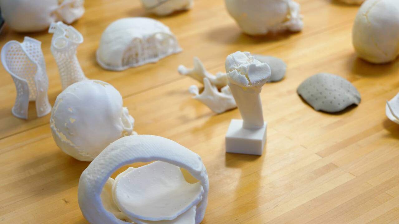 Beispiele aus dem 3D-Druck-Labor an den Salzburger Landeskliniken. 