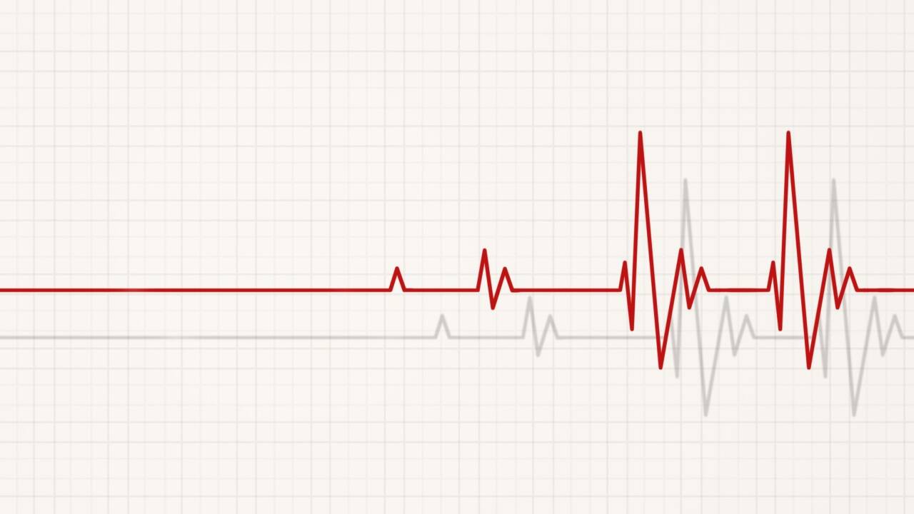 In der Medizin spricht man von einem „Lazarus-Phänomen“, wenn Herz-Kreislauf-Funktionen nach einem für erfolglos erklärten und beendeten Wiederbelebungsversuch überraschend wiederkehren.  