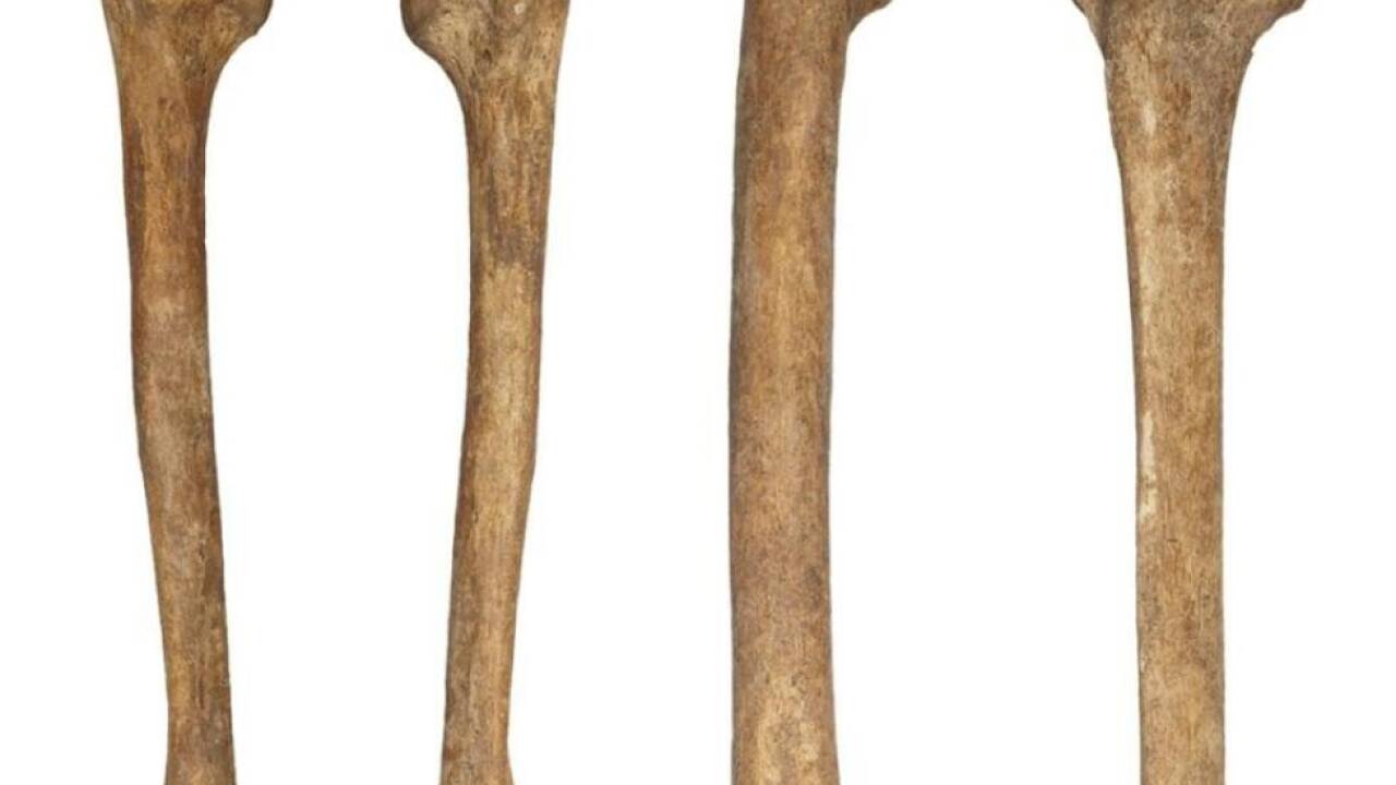 Oberarm-, Oberschenkel- und Schienbeinknochen eines jungsteinzeitlichen Skeletts aus dem NHM 