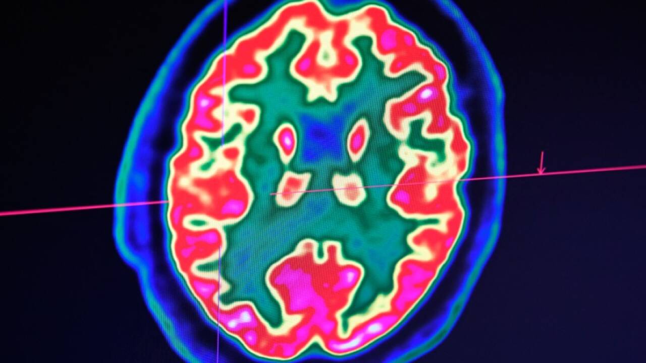 Laut Schweizer Medizinern Meilenstein für Therapie 