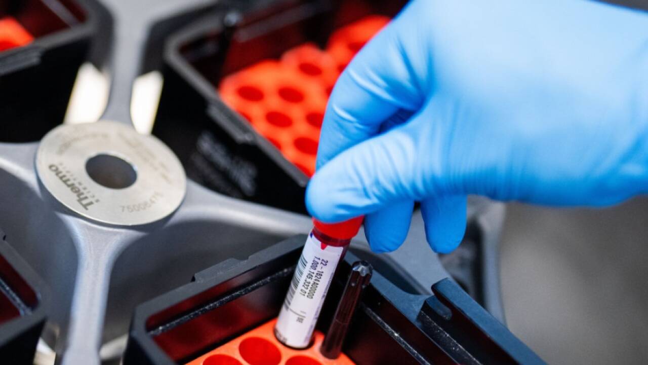 PTX-3-Spiegel bei Betroffenen zehn Wochen nach Infektion stark erhöht 