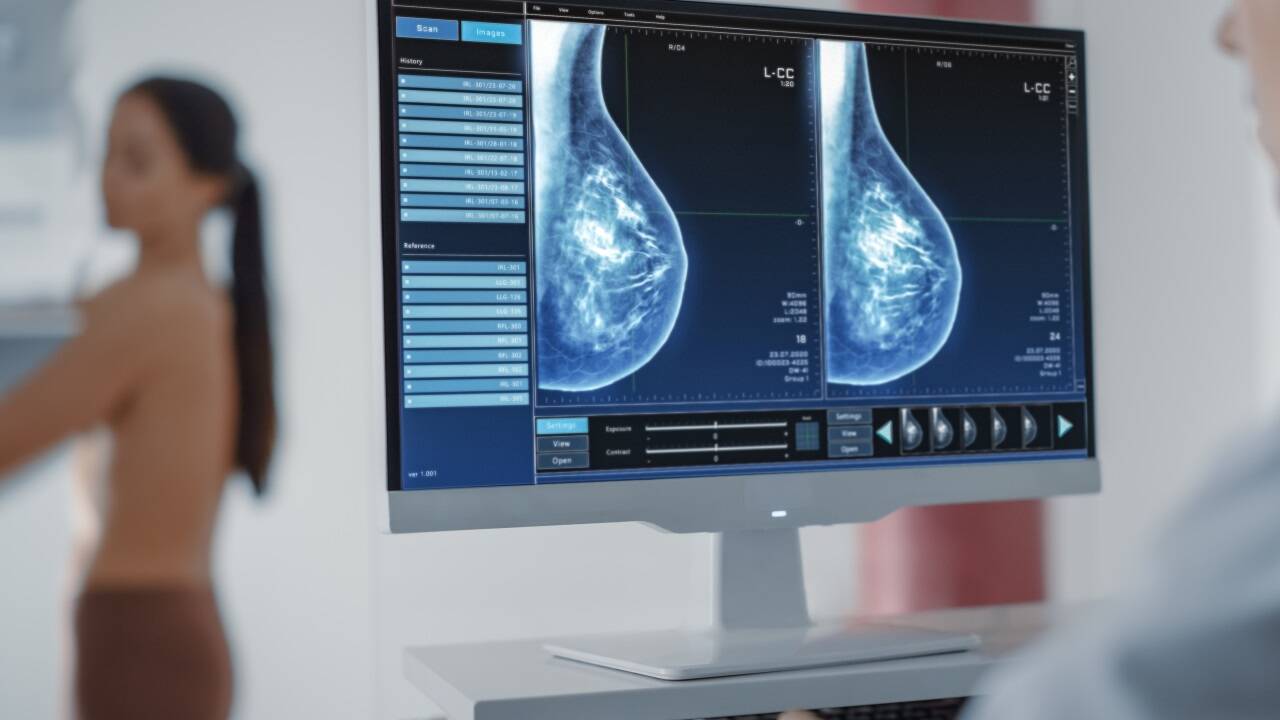 Ein funktionierendes Brustkrebsscreening ist für eine frühe Diagnose wichtig. Dies wiederum kann Betroffenen belastende Therapien ersparen.  