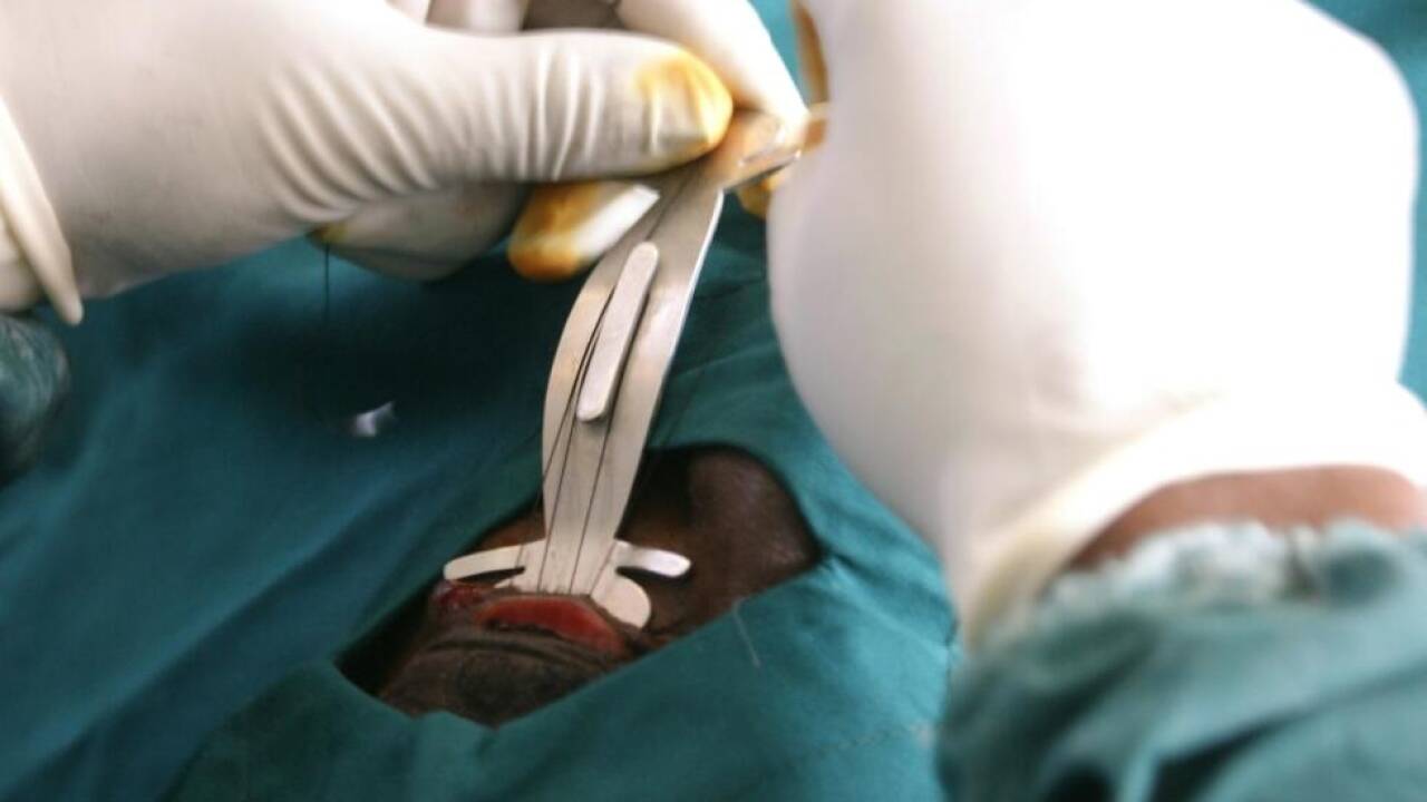 Trachom-Operation in Äthiopien: Die Wimpern werden nach außen gestülpt 