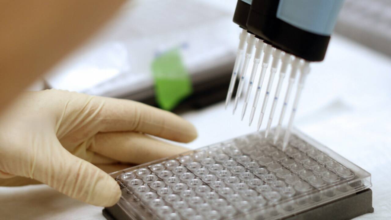 Eine klinische Studie ist derzeit im Laufen 