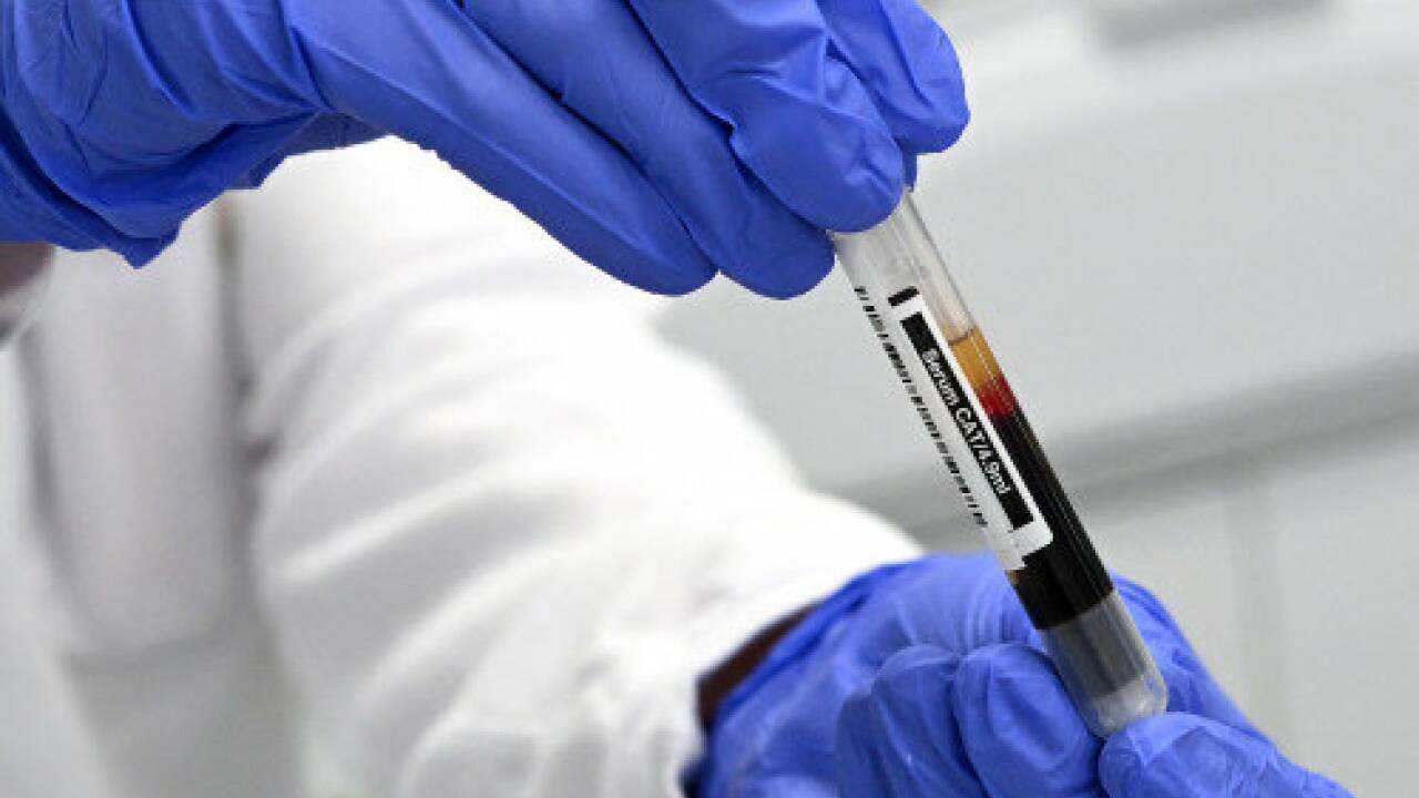 Zürcher Forschende haben ein neues Mittel gegen Eisenmangel entwickelt (Symbolbild). Zürcher Forschende haben ein neues Mittel gegen Eisenmangel entwickelt (Symbolbild).