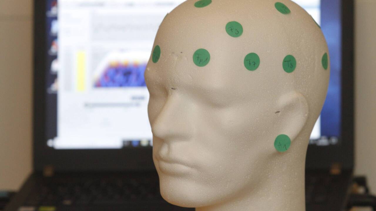 Neurofeedback – die grünen Punkte markieren mögliche Kontaktstellen für Elektroden. 