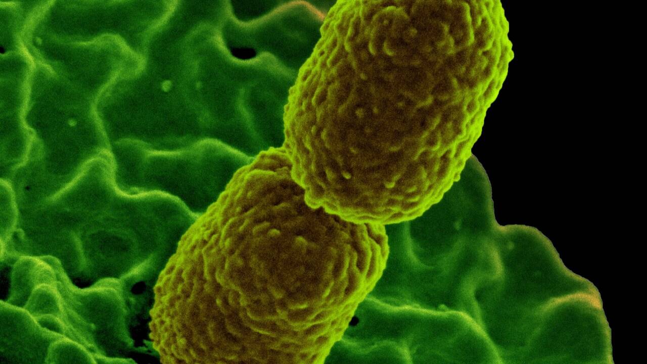 Das ist das Lungenentzündungen verursachende Bakterium Klebsiella pneumoniae. 