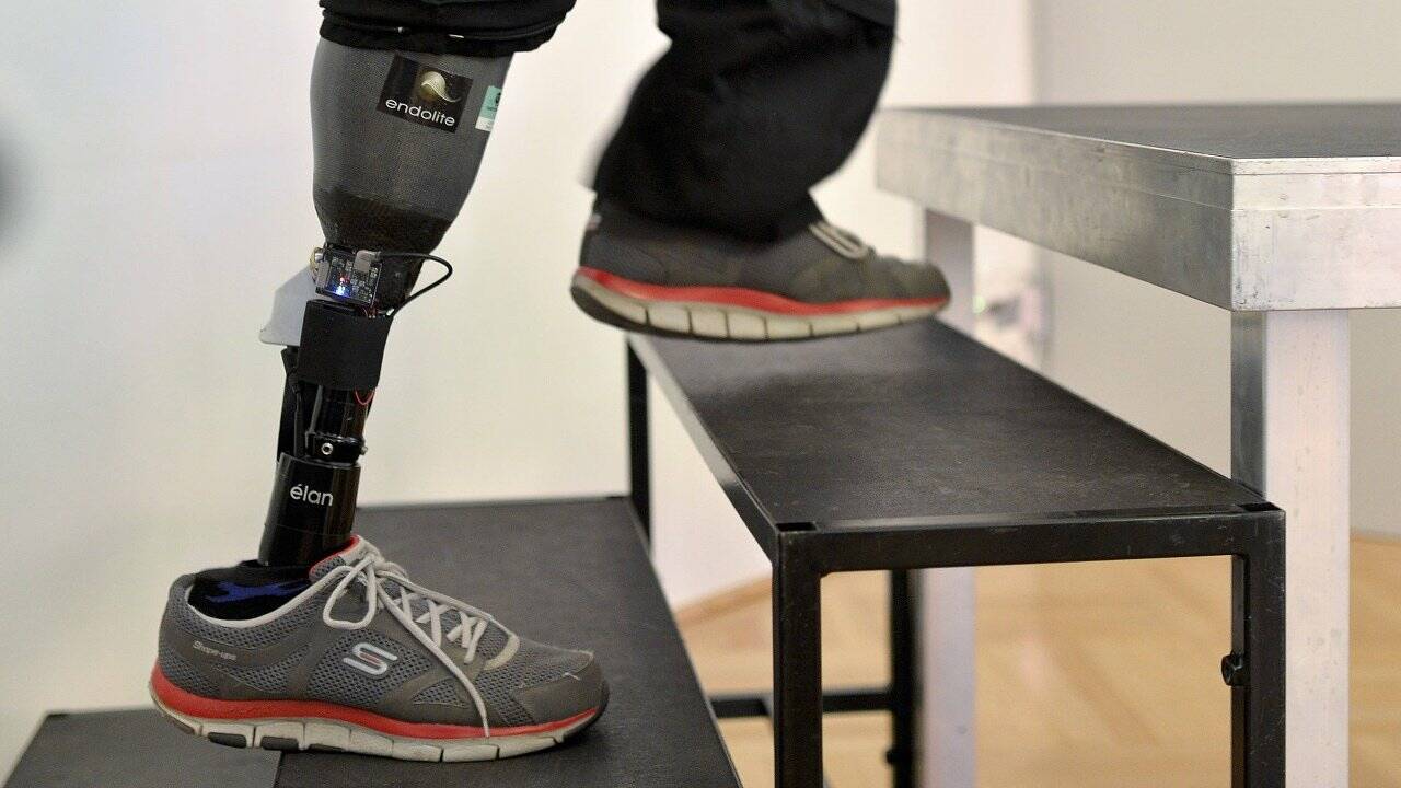 Österreicher trägt erste fühlende Beinprothese der Welt