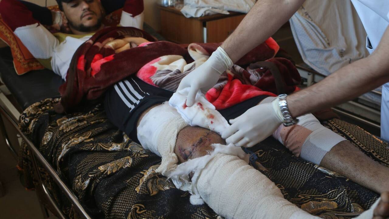 Am Bein verletzter Demonstrant im Al-Shefa-Krankenhaus (Gaza Stadt). 