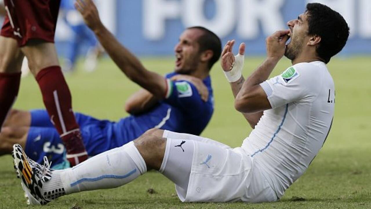 Von Beißern und Freigängern: Kurioseste WM-Wetten