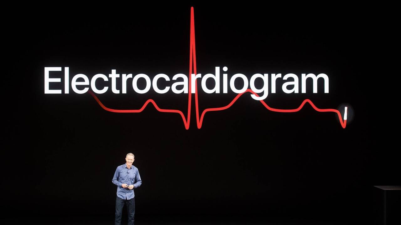 Die Apple Watch 4 ist auch ein EKG-Messgerät. 