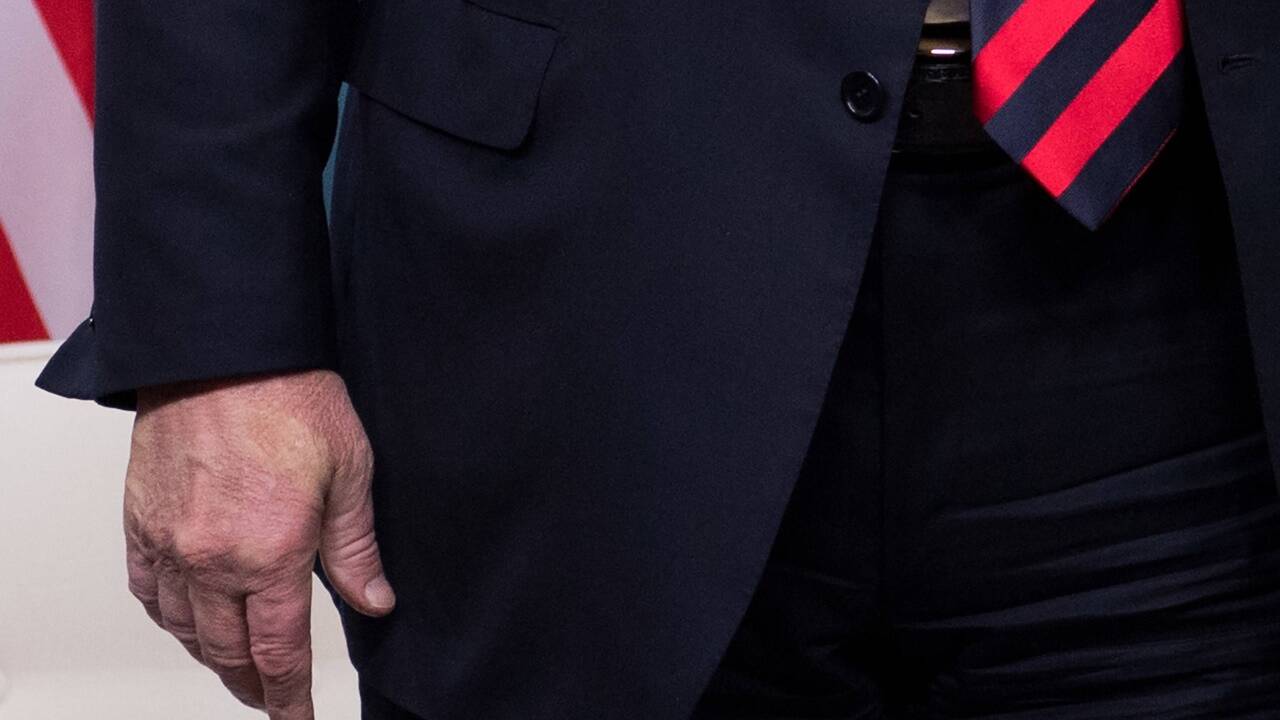 Macrons Daumen hinterlässt einen weißen Abdruck auf Trumps Handrücken. Macrons Daumen hinterlässt einen weißen Abdruck auf Trumps Handrücken.