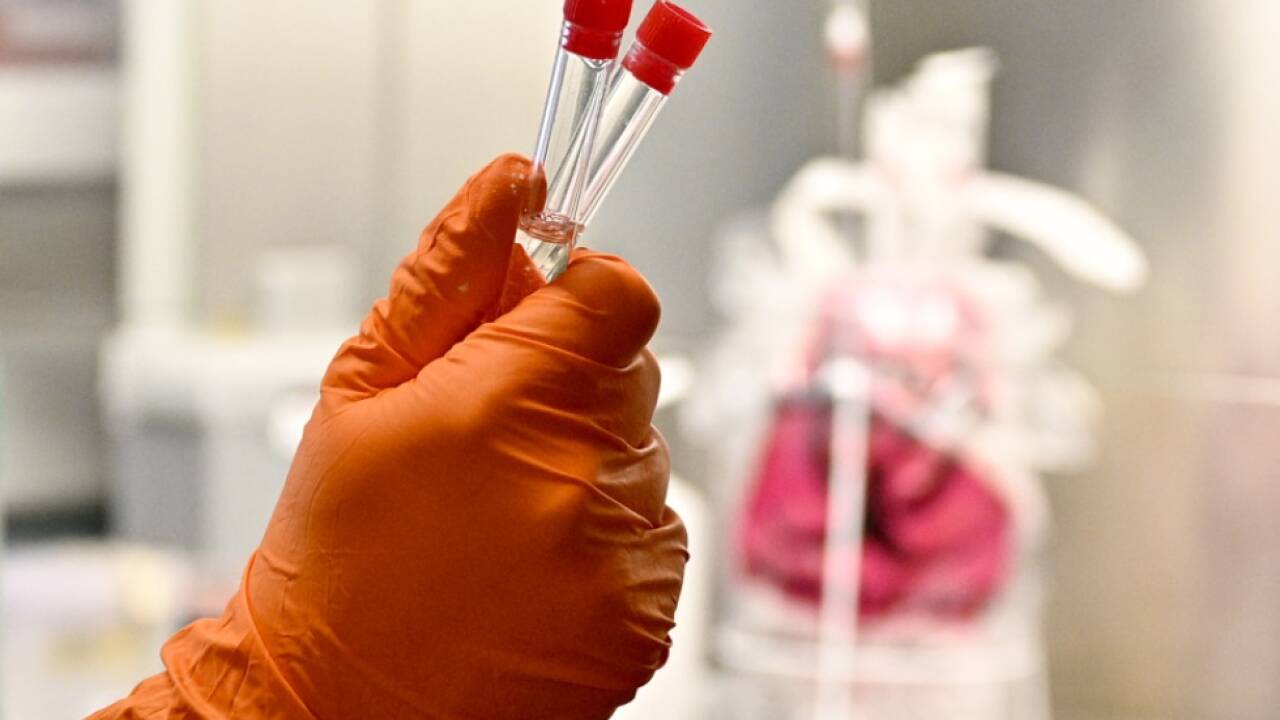 Immer mehr positive Tests auf den Coronavirus in Österreich. Immer mehr positive Tests auf den Coronavirus in Österreich.