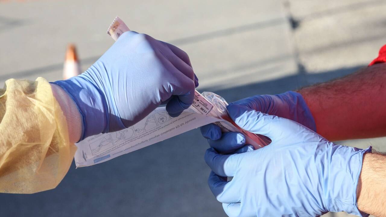 Die Zahl der bisher in Salzburg positiv auf Covid-19 getesteten Personen beträgt 1.236. Die Zahl der bisher in Salzburg positiv auf Covid-19 getesteten Personen beträgt 1.236.