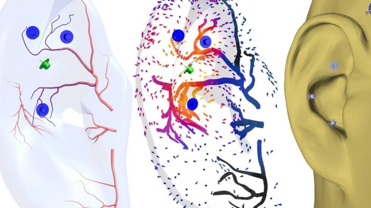 Diese Bilder der TU Wien illustrieren, wo die Forscher aufgrund exakter Analysen von Nervenbahnen und Blutgefäßen optimale Punkte für die Stimulierung des Vagusnervs gefunden haben.  