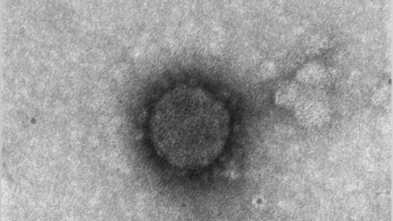 Eine elektronenmikroskopische Aufnahme eines Coronavirus. Eine elektronenmikroskopische Aufnahme eines Coronavirus.