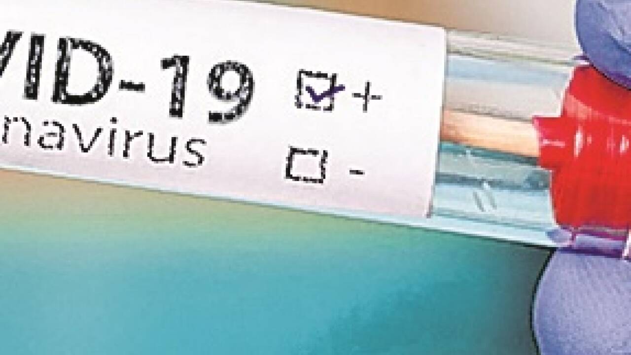 Corona-Tests können teuer kommen. Corona-Tests können teuer kommen.