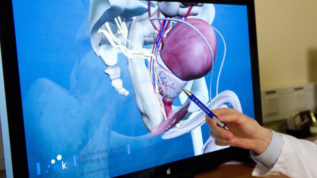 Prostatakrebs ist bei Männern die zweithäufigste Krebsart.  Prostatakrebs ist bei Männern die zweithäufigste Krebsart.